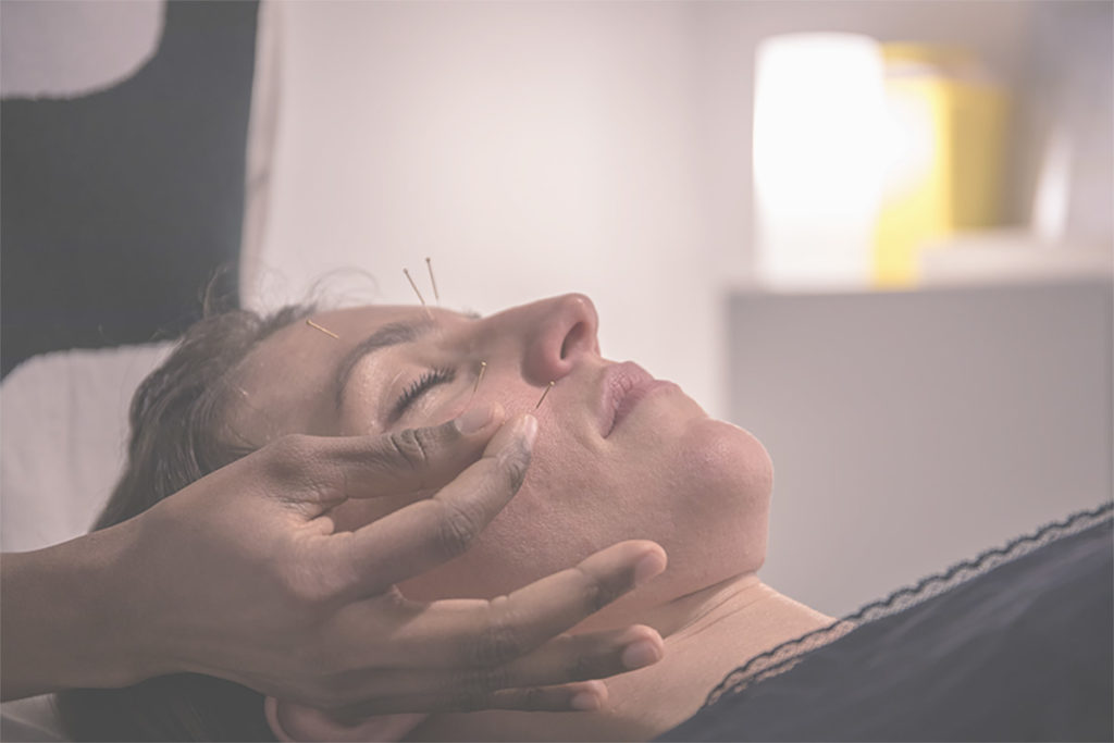 anabel-chatellier-aculift-lifting-acupuncture-paris
