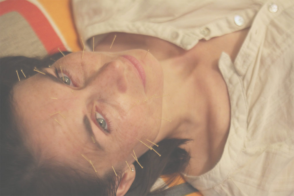 anabel-chatellier-aculift-lifting-acupuncture-paris3